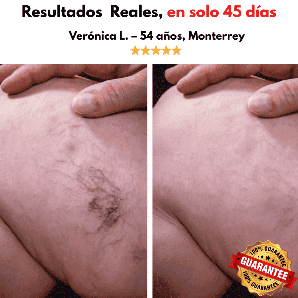FIRMEA SMOOTH PRO™