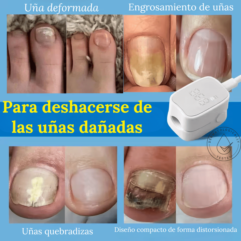 LASER CURE NAIL PRO™