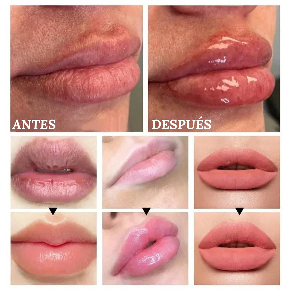 LIP PLUMPER