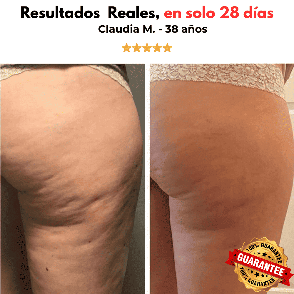 FIRMEA SMOOTH PRO™
